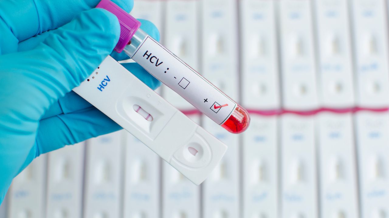 reka-w-niebieskiej-rekawiczce-trzyma-hcv-test-probowka