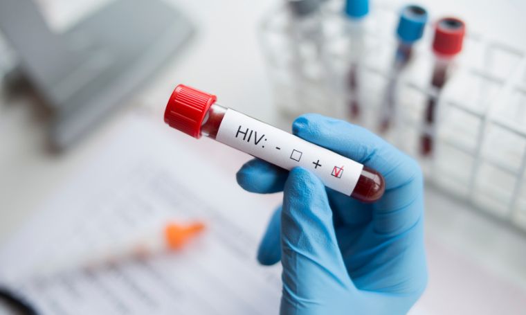 laborant-trzyma-probowke-hiv-badanie-krwi-dodatni