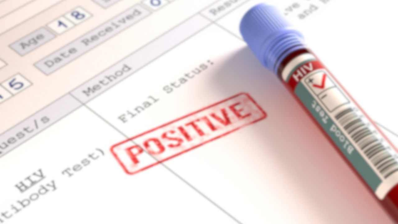 test-na-hiv-pozytywny